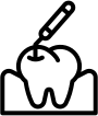Lost Fillings - Emergency dentist Oxshott