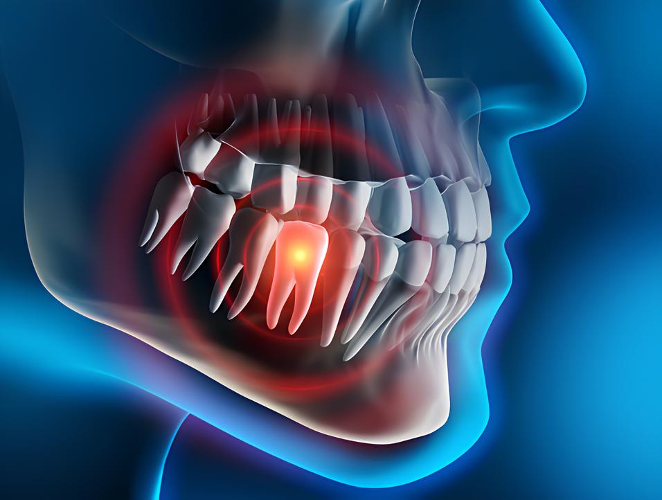 Teeth image - Emergency dentist Oxshott